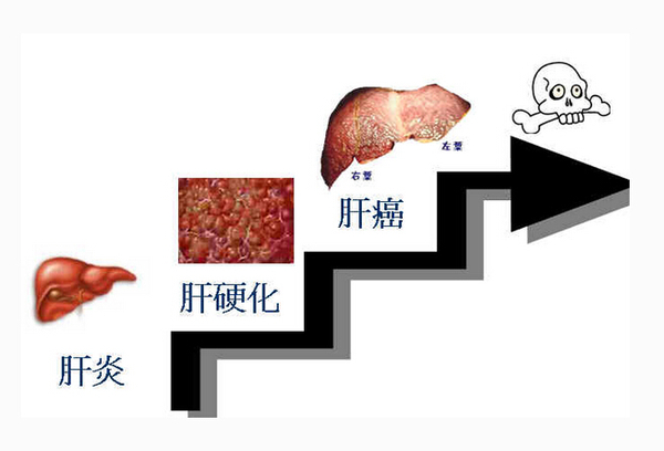 肝炎治疗药物市场